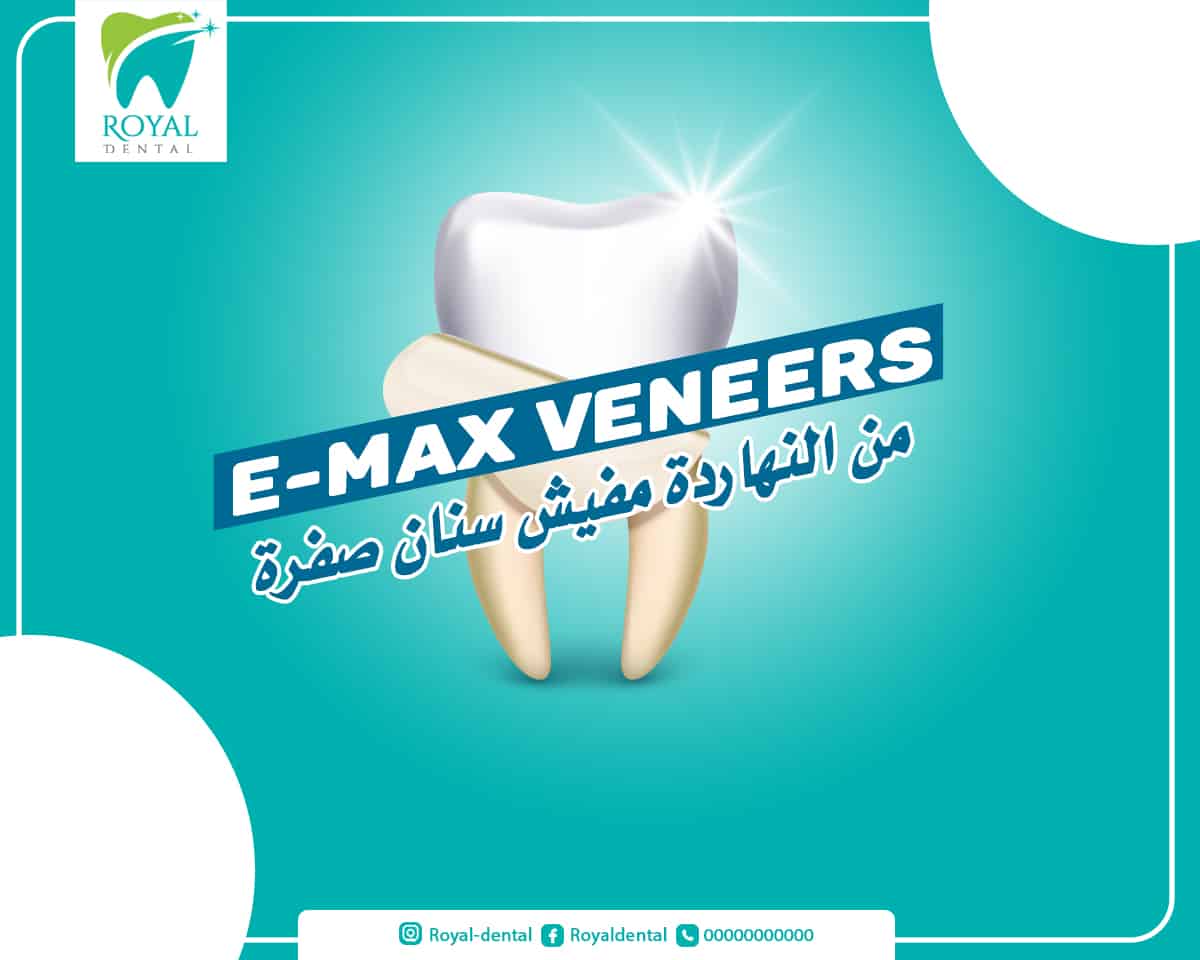 مشروع تصميمات سوشيال ميديا لعيادة أسنان